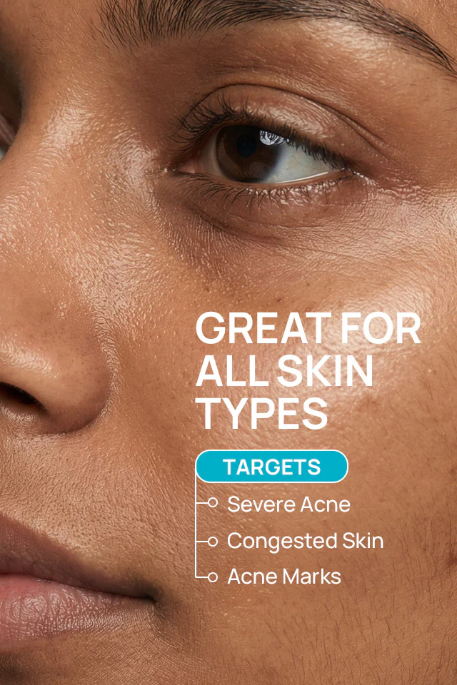BreakFree From Acne Combo - Image 5