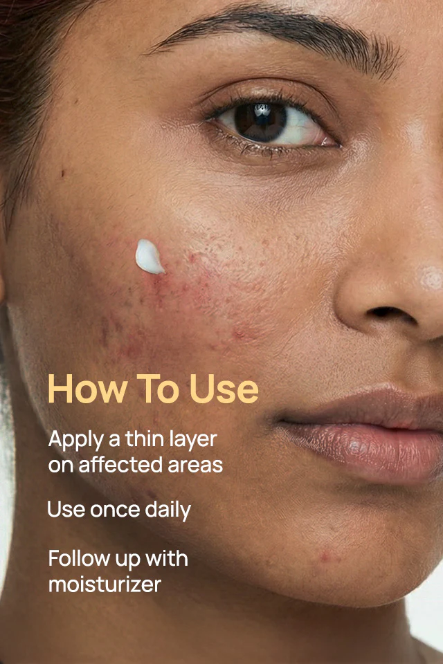 Acne-Limit Facial Cream - Image 6