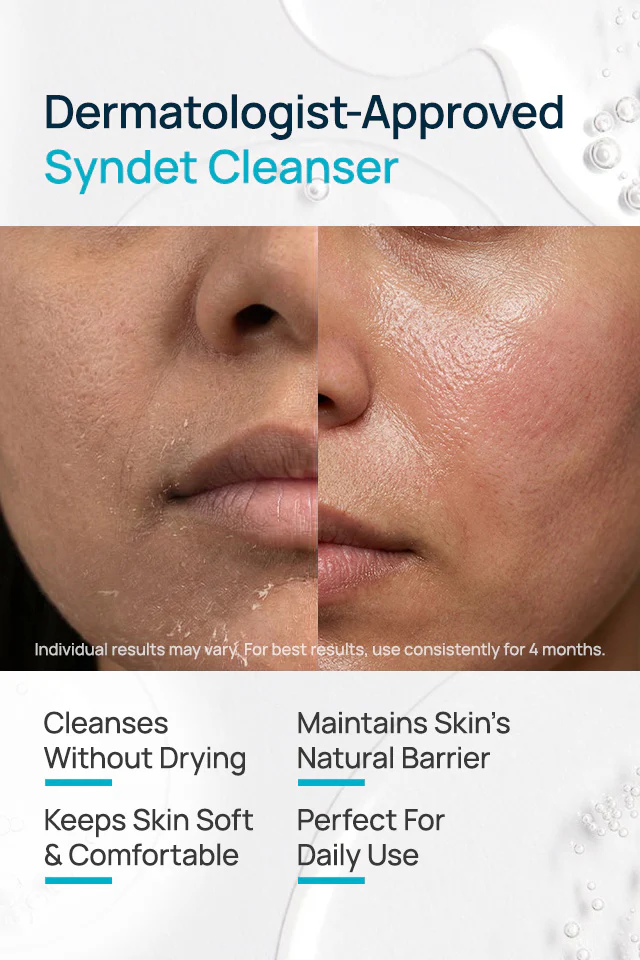 Syndet Face Cleanser - Image 3